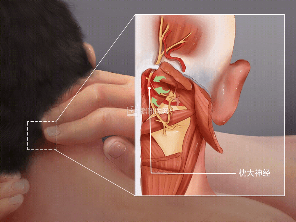 枕头高点好，还是矮点好？答案只有这一个(图4)