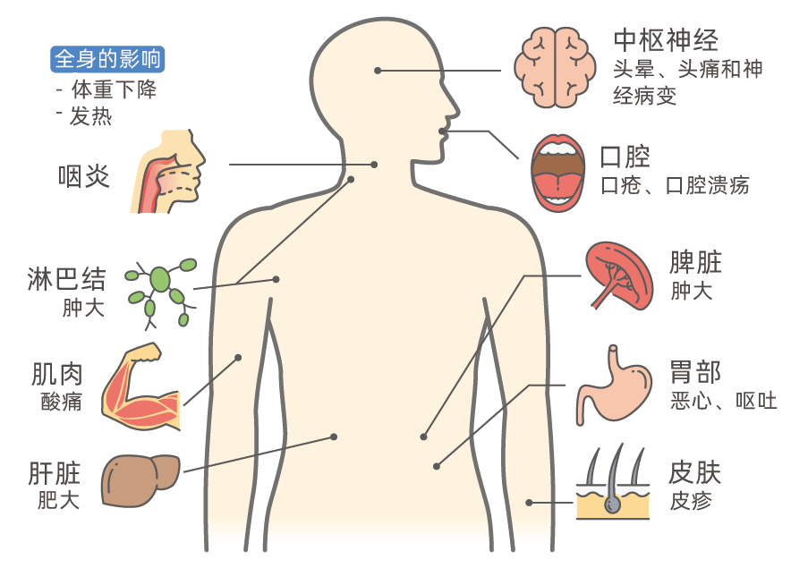 全球已有5名艾滋病患者被治愈，距离终结艾滋病还有多远？(图3)