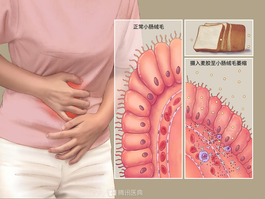 彩虹云商城24小时在线自助下单平台,大便粘马桶是肠癌前兆吗？(图4)